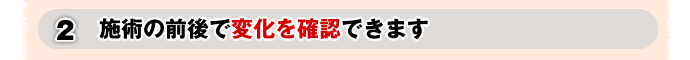 2.施術の前後で変化を確認できます